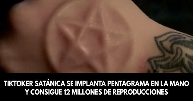 TikToker se implanta pentagrama en la mano y consigue doce millones de reproducciones